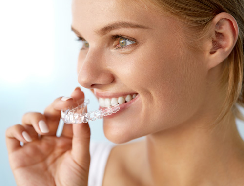 Invisalign, un’unica soluzione per tanti problemi