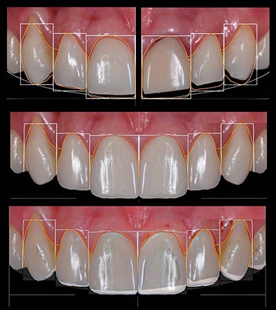 Smile design: il sorriso ora è anche digitale